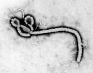 úspěchů virologie se datuje do roku 1993, kdy byl zkompletován genom viru pravých neštovic (http://jpkc.ynau.edu.cn/course/zwbl/shuo/molvirol/data/app3.htm). Obr. č.