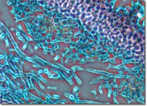 ztráta lichenismu během evoluce (Eurotiomycetes) přechodné