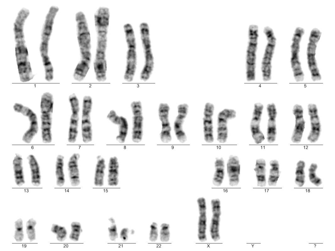 Obrázek 5: Fyziologický karyotyp ženy 46,XX (Foto: RNDr. Kateřina Adamová, PhD, Ústav lékařské genetiky a fetální medicíny Fakultní nemocnice v Olomouci) 2.3.