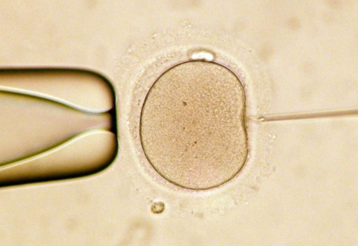 vybrána morfologicky nejvhodnější spermie. Pomocí mikromanipulátoru je vajíčko přidrženo a spermie je do něj vpíchnuta.