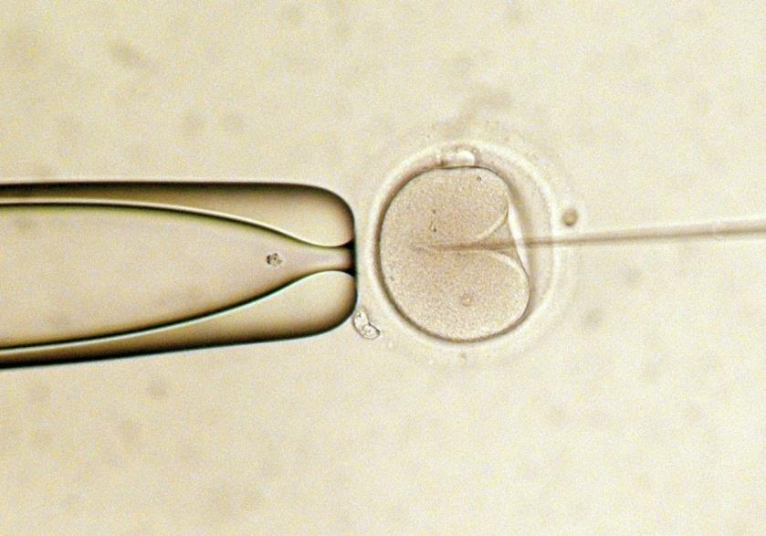 Obrázek 7: Intracytoplazmatická injekce spermií. V levé části pipeta přidržující vajíčko, v pravé části jehla se spermií.