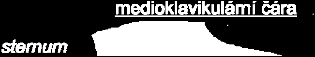 3: Šest unipolárních svodů podle Wilsona (V1 V6) [6] Pro hrudní unipolární svody platí (3), že: U VN ( Φ +Φ +Φ ) R L F ΦW = = 0 =Φ VN 3 Φ W [ mv] [ mv] kde Φ VN jsou