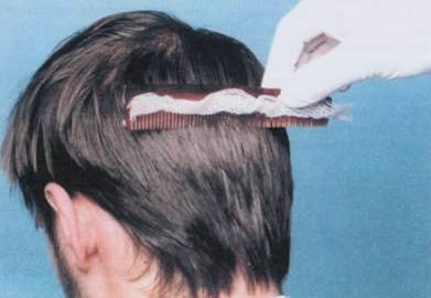 Tento způsob je vhodný pouze při zajišťování povýstřelových zplodin z vlasů a vousů.