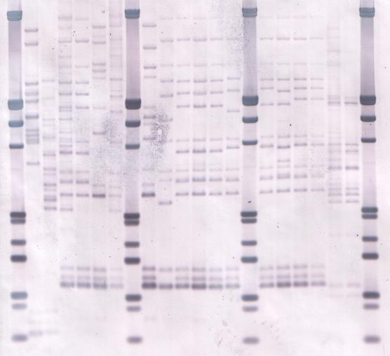 Typizace bakteriálních izolátů ribotypizace selektivní hybridizace a následná detekce restrikčních fragmentů genomové DNA nesoucích geny pro rrna buněčná kultura izolace DNA