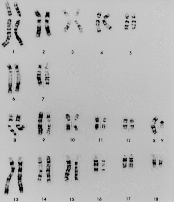 19 3.3 Genom prasete Genom je veškerá genetická informace uložená v DNA (u některých virů v RNA) konkrétního organismu, a to v chromozomech a mitochondriích.