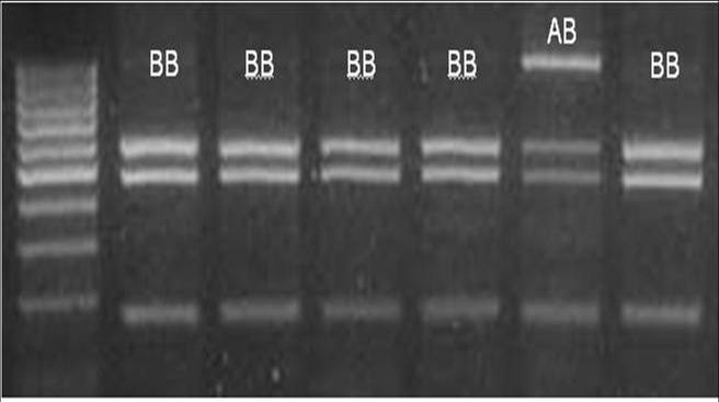 Obr. 17 MYF5 PCR produkty délky 1200 bp 1500 bp 1200 bp Obr.