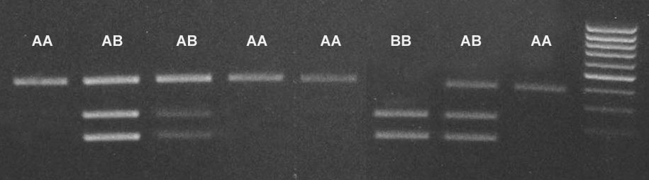 20 Štěpení MYF6 enzymem BseRI 1 2 3 4 5 6 7 8 9 1-8 naštěpené PCR produkty 9 - GeneRuler 100 bp DNA Ladder o délkách 1031, 900, 800, 700, 600, 500, 400,