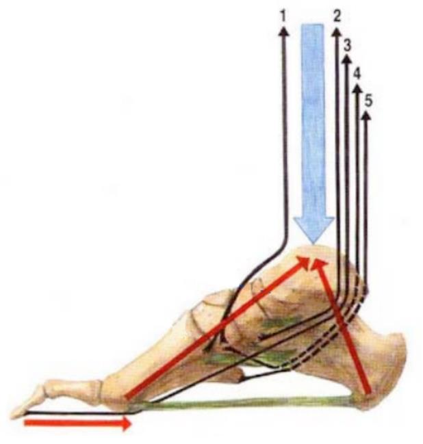 m. fibularis brevis. Zeleně jsou vykreslena ligamenta udržující systém kleneb, zatímco červeně je vylíčena výslednice tahu bércových svalů. [5] Obr. č. 8 Mechanismus udržování klenby nožní [5] 2.
