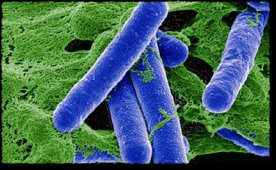 výskyt peptidů v potravinách: botulotoxiny Botulotoxiny (klobásový jed) bakterie Clostridium botulinum peptid z 19 AMK neurotoxin (poškození CNS až smrt) Nalezeny ve většině potravin Rizikové