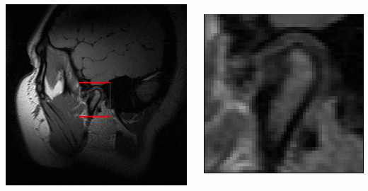 Obr. 40 Snímek lidské hlavy s rozlišením 256x256 bodů, řez s viditelným
