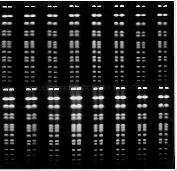 RGE Figure 3. Rotating gel electrophoresis (RGE) separation Saccharomyces cercevisiae chromosomes (245-2190 kb). Run conditions: 180 V, 5.1 V/cm, 34 hrs., 120 angle, 60-120 sec.