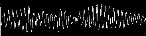 defibrilaci - adrenalin 0,01 mg/kg