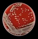 Původci alimentárních onemocnění Bakterie