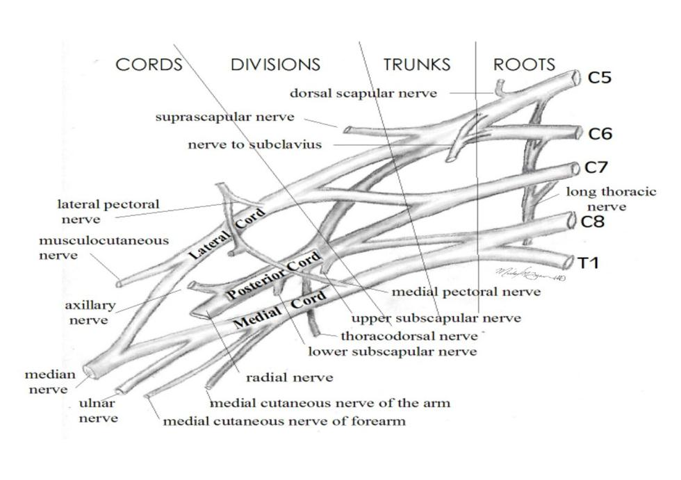 Obrázek 1 Schématický obrázek plexus brachialis (Ruchelsman et al., 2009) 2.2 Poranění periferního nervu a schopnost regenerace Dle závaţnosti poškození nervu lze rozlišit 3 stupně léze.