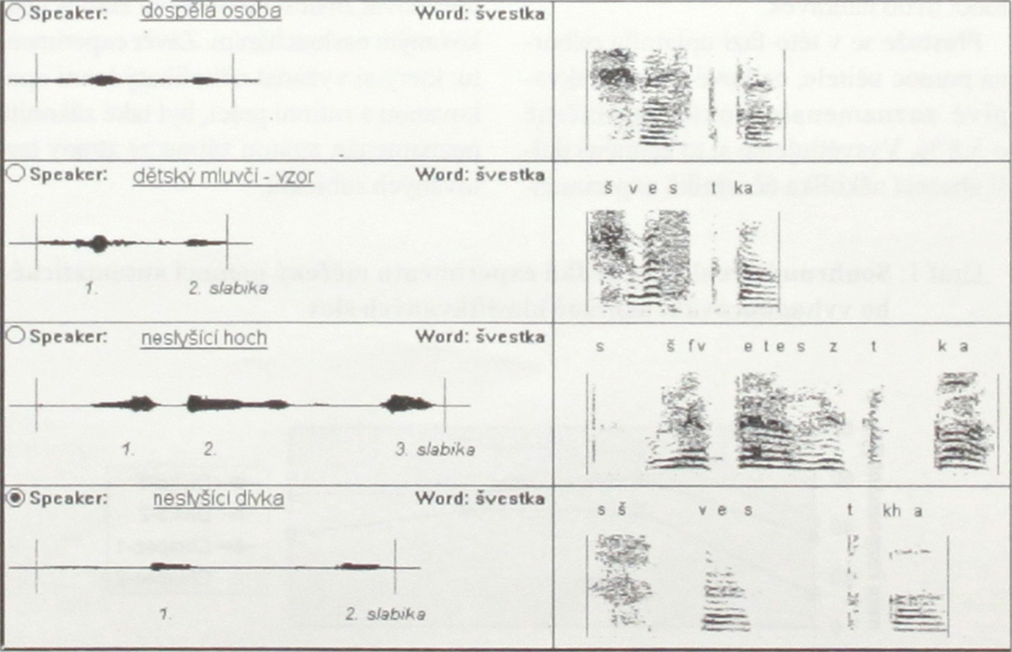 U těchto nahrávek bylo záměrně usilováno o pomalejší tempo výslovnosti, srovnatelné s tempem neslyšících osob - viz obr. 1. Do nácviku konkrétních slov nezasahovaly žádné další osoby.