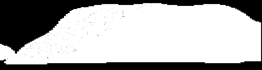 cap Diabetes Mellitus Homocystein Fibrinogen impaired Fibrinolysis Ruptura plátu