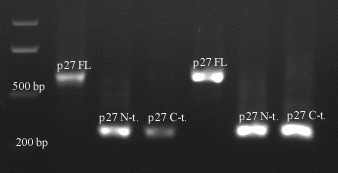 PLATINUM Pfx DNA PLATINUM Pfx DNA polymeráza polymeráza + Enhancer solution Taq DNA polymeráza Obr. 2: PCR amplifikace celé sekvence, jeho N-koncové a C-koncové části.