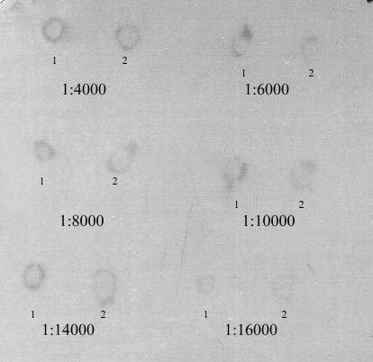 Obrázek 21: Optimalizace koncentrace sekundární prasečí protilátky proti králičím protilátkám pro detekci proteinů značených FLAG peptidem pomocí metody Dot blot.