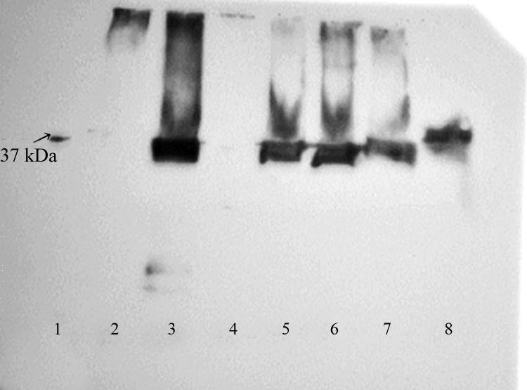 2,5 µl 2-merkaptoethanolu.