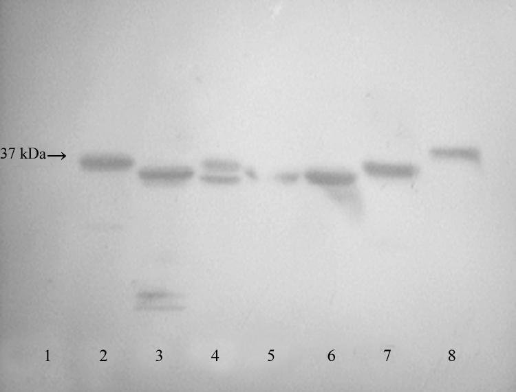 ředění protilátek 1:16000 u vzorků č. 3, 5, 6, 7, 8 je dostačující ke spolehlivé detekci proteinů značených FLAG peptidem. Tímto ředěním byl omezen i výskyt nespecifických vazeb protilátek.