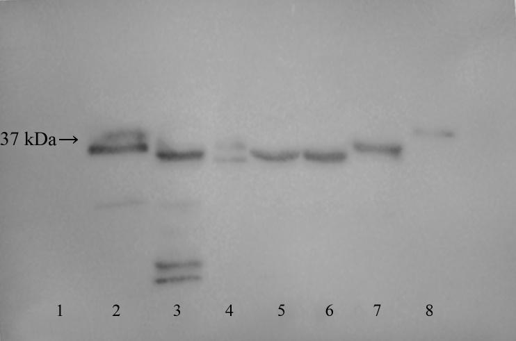 Obrázek 24: Detekce proteinů značených FLAG peptidem- optimalizace úpravy vzorků, změněný faktor - přídavek 8M močoviny.