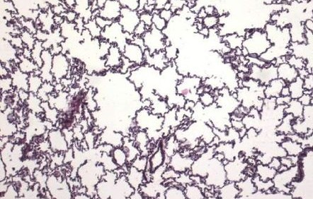 Obr. 4: Histologický preparát z plic 1 V plicních sklípcích probíhá vlastní výměna plynů, zejména O 2 a CO 2, mezi krví a vzduchem.