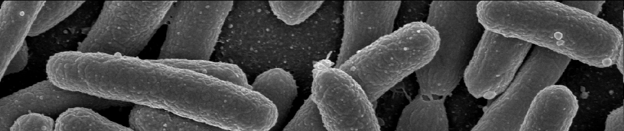 Escherichia coli Gramnegativní pohyblivá paličkovitá bakterie.