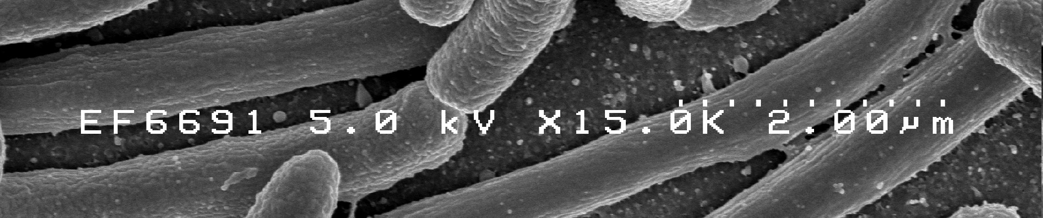 Streptomyces Grampozitivní vláknité bakterie. Je aerobní, saprofytické.