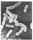 Obr. 4 Lactobacillus