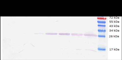 Fosfohistidin (phis) WB standardu GFP typ fosforylované prostředí aminokyseliny kyselé zásadité fosfoserin stabilní nestabilní O-fosfáty fosfothreonin stabilní nestabilní fosfotyrosin stabilní