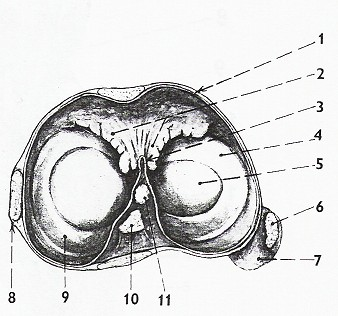 Obr. 10 Plica synovialis patelaris a plicae alares 1. capsula articularis )se synoviální embránou) 2. plica alaris 3. řez synoviální membránou v místě plica synovialis patellaris 4.