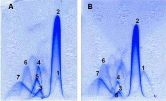 Dvojrozměrná (křížová) imunoelektroforéza crossed immunoelectrophoresis Kombinace zónové elektroforézy a raketové imunoelektroforézy 1965 LAURELL, LAURELLOVÁ 1966 CLARKE H.G.M., FREEMAN T.