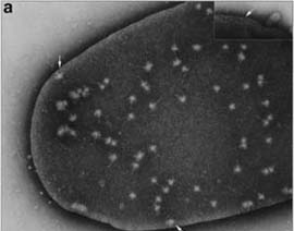 Střevní infekce bakteriálního původu Shigella sonnei, S. flexneri, S. dysenteriae, S.