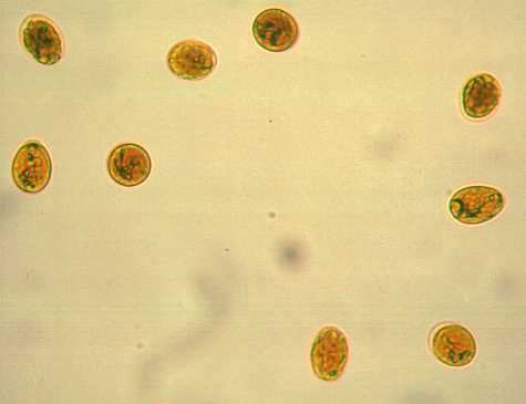 Alimentární infekce - protozoa Giardia lamblia - dg.