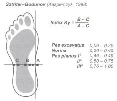 Hodnocení se provádí podle střední části planty. Pokud otisk přesáhne linii A, jedná se o plochou nohu.