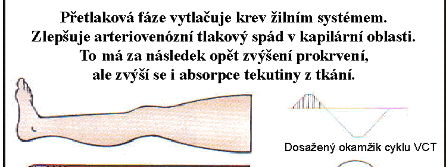 Principem metody vakuově-kompresní terapie je tedy působení střídajícího se hyperbarického a hypobarického prostředí na ošetřovanou dolní nebo horní končetinu.