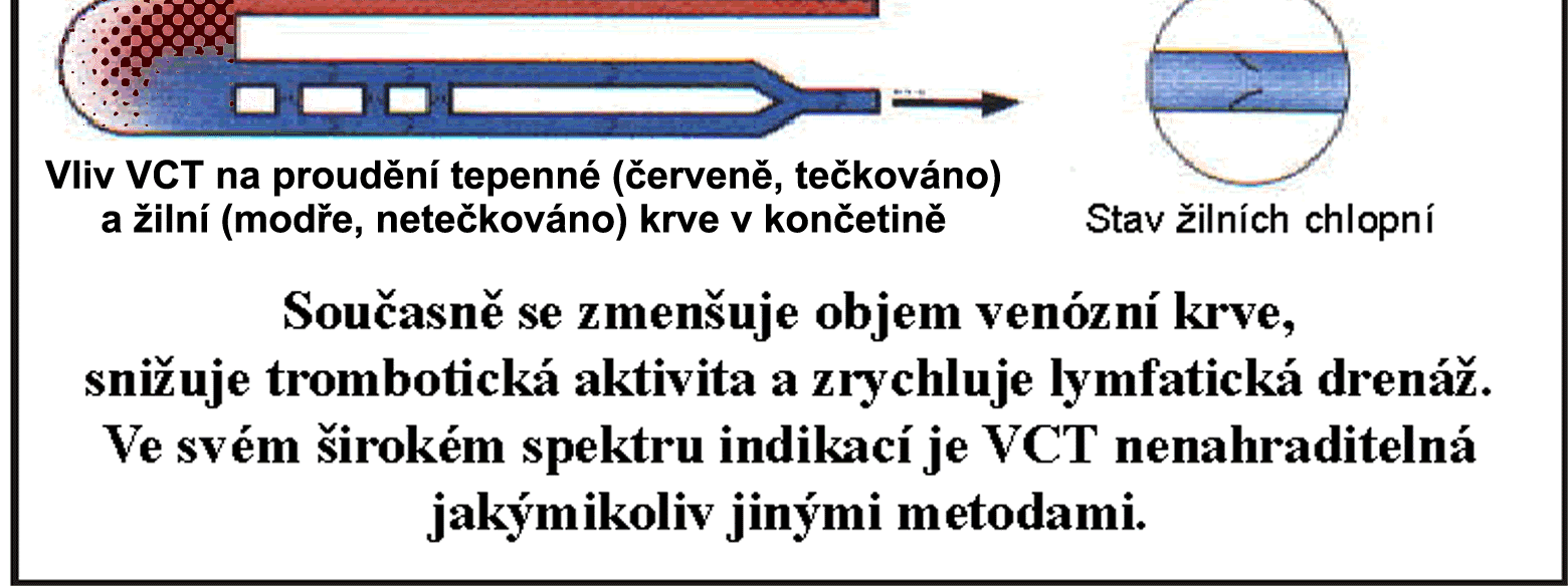 Přístroj EXTREMITER 2010 edice BETTER FUTURE řeší nafukování této těsnicí manžety plně automaticky.