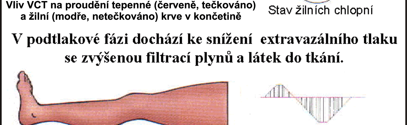 Tím se prokazatelně významně a dlouhodobě zlepšuje trofika (výživa) i metabolismus tkání v oblasti léčené končetiny a dokonce i v dalších částech těla v její blízkosti. Obr. 1.