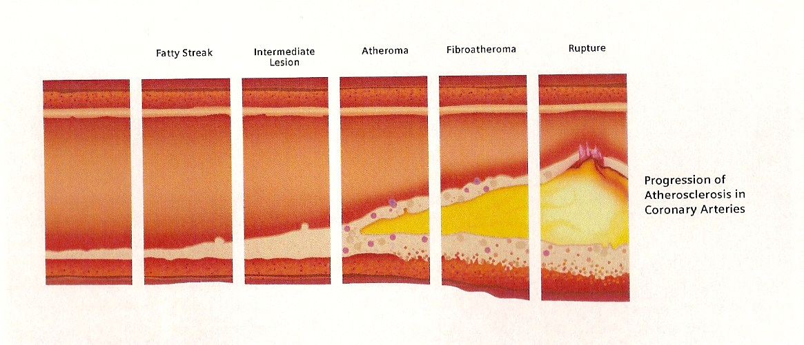 Nukleární kardiologie Zobrazování perfuze a funkce levé komory