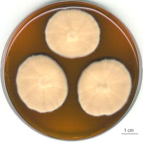 Aspergillus