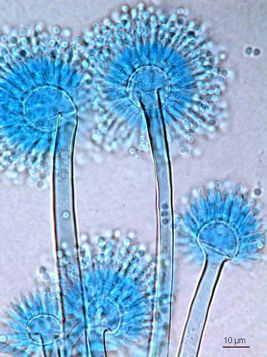 Aspergillus