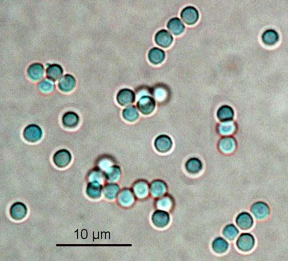 Aspergillus