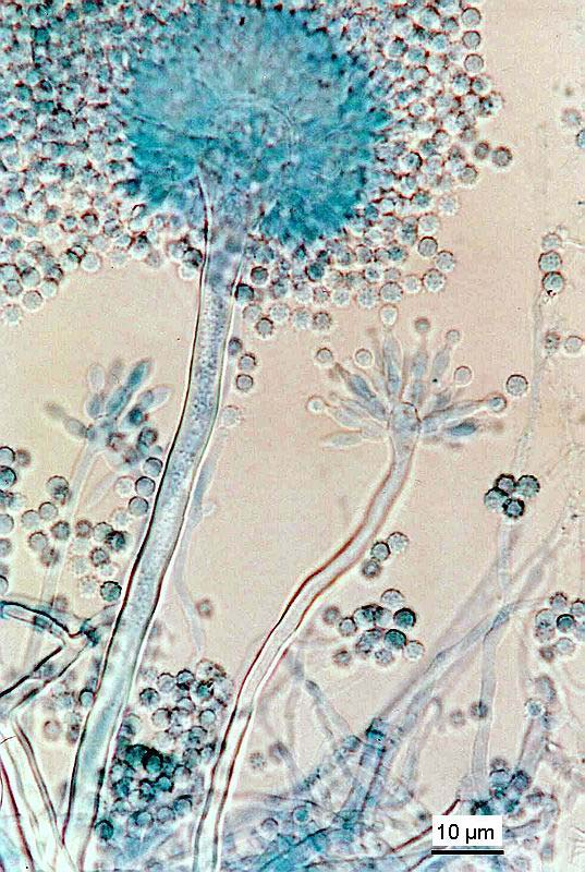 Aspergillus