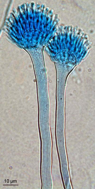 Aspergillus