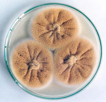 Aspergillus - makroskopické znaky kolonií Kolonie se hodnotí na standardních živných médiích: CYA, MEA při standardní kultivační teplotě: 25 C, 37 C Nejvýznamnější