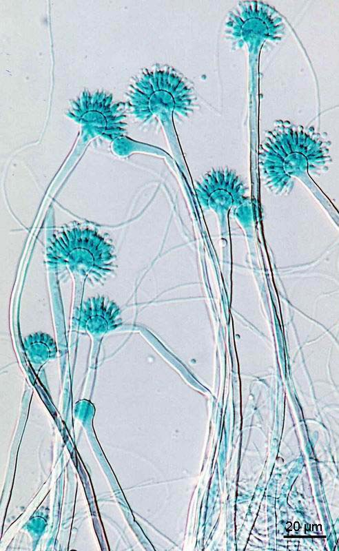 Aspergillus