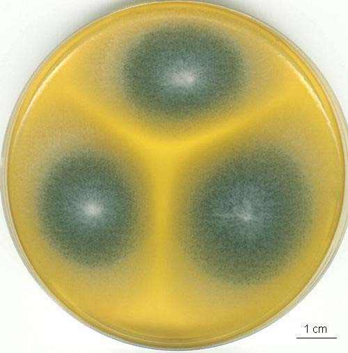 Aspergillus