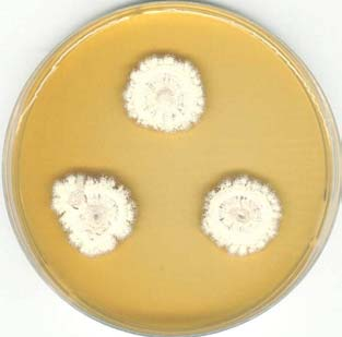 Aspergillus - makroskopické znaky kolonií zbarvení