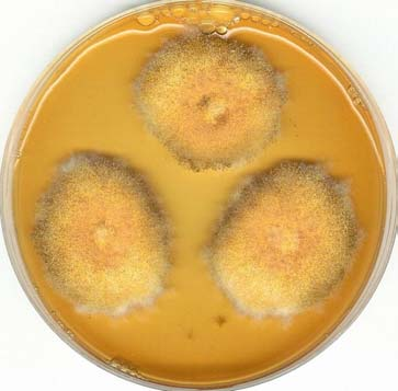 Aspergillus identifikační média Doporučená identifikační média: CZ, CYA, MEA CYA MEA