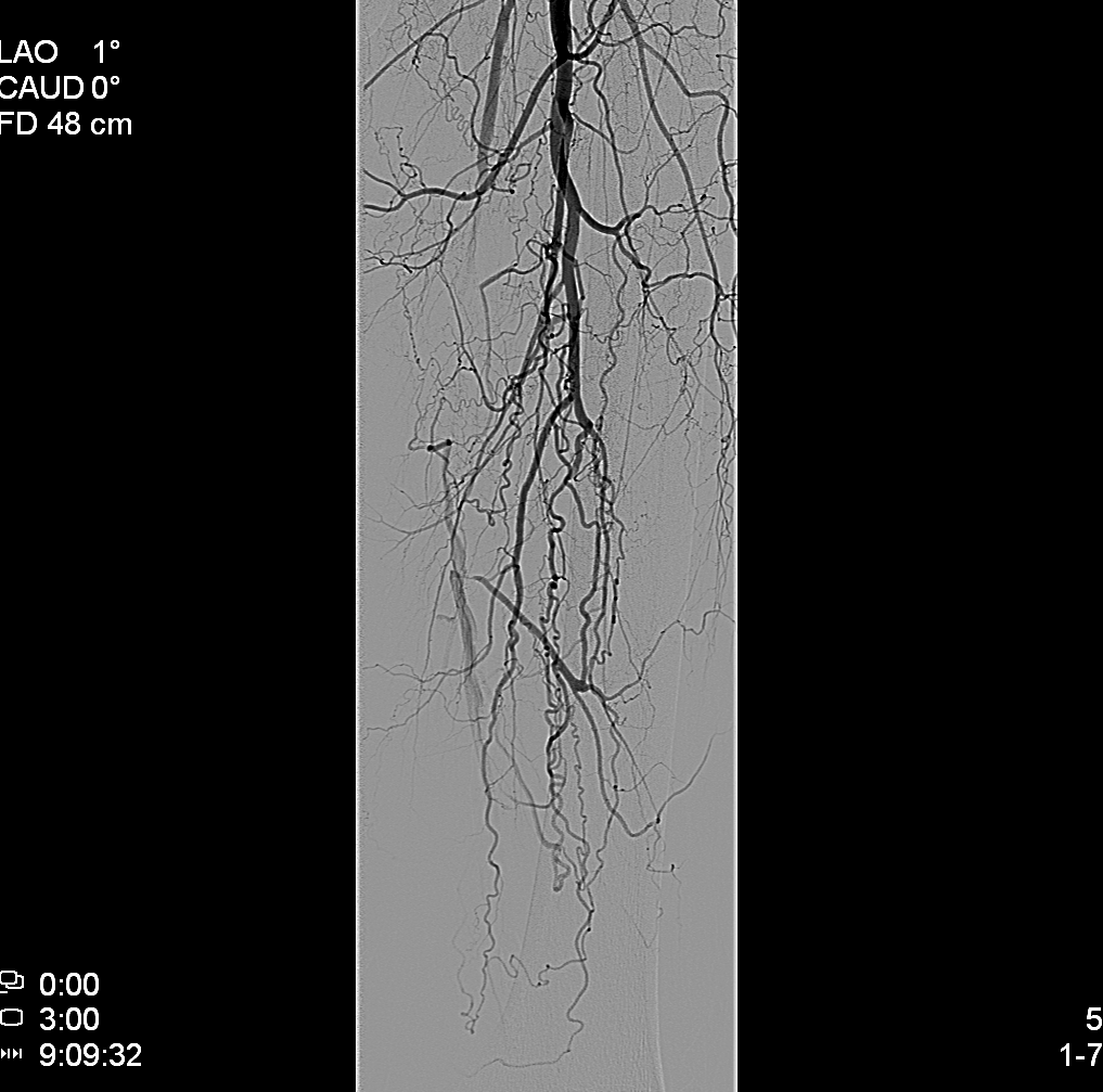 Izolovaná systolická hypertenze, nově diagnostikovaná Dyslipidemie Chronický vertebrogenní algický syndrom LS